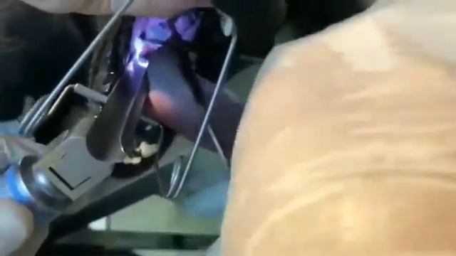 Все еще даете собаке кости? смотреть онлайн