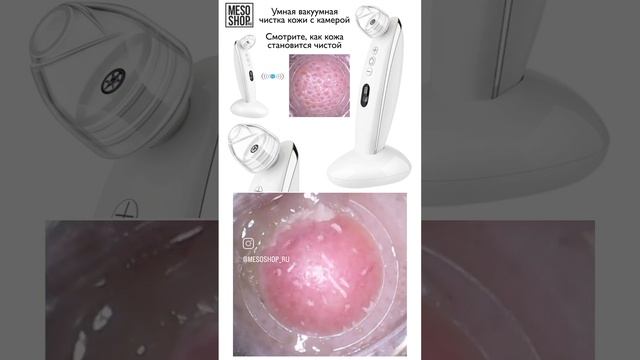 Умная чистка лица. Вакуумная ручка с wifi камерой.