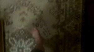 Перелом голеностопа,голени,ноги. 2 ой день после снятия гипса