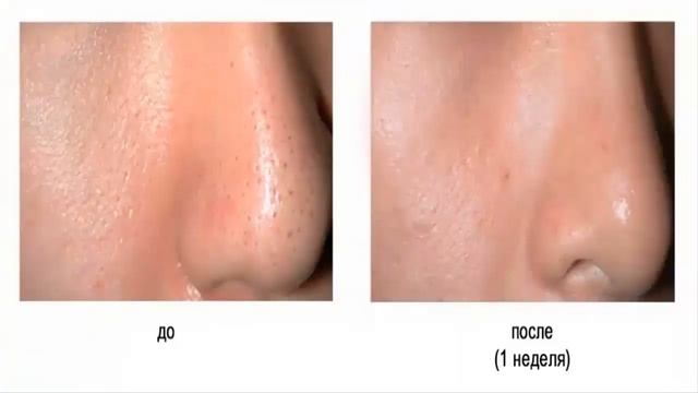 Лафхак! тайна вечной молодости раскрыт. Кокон тутового шелкопряда. смотреть онлайн