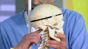 Опухоль основания черепа. Это не приговор! Жить здорово! Фрагмент выпуска от 01.08.2013