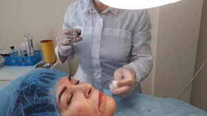 Контурная пластика средней и нижней третей лица