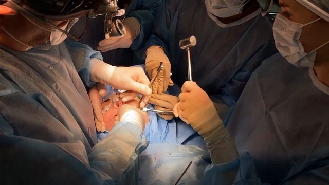 Операция остеотомия верхней и нижней челюсти. Гениопластика и отопластика