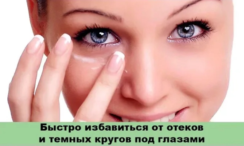Отеки и темные круги под глазами - как быстро избавиться в домашних условиях