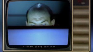 Реклама пересадки волос, 1999 г.