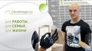 Протез на вычленение с внешним источником энергии и многосхватной кистью – уникальный протез