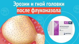 ? Эрозии и гной головки после флуконазола. Клинический случай №1060