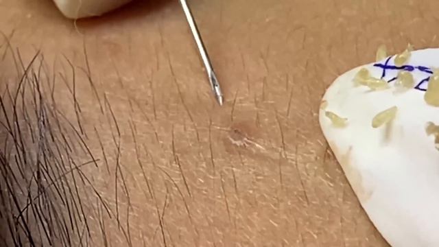 Enjoy Your Day With Hien Nguyen Spa # 1766 смотреть онлайн