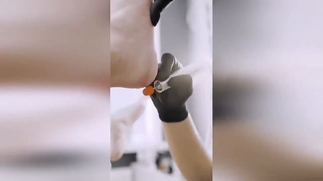 Забота о Ваших стопах: Всё, что Вам нужно знать о перекиси водорода! смотреть онлайн