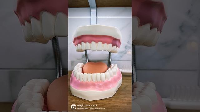 Тотальная имплантация зубов в Сочи. Протезирование на имплантатах Dentium