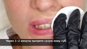 Как подготовить Губы к перманентному макияжу