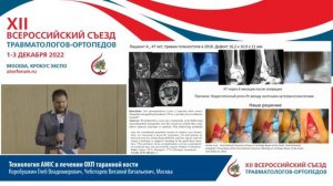 Остеохондропатия таранной кости. Актуальность. Обследование. ТерминологияСорокин Евгений