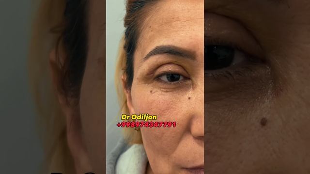 Manzil TOSHKENT va JIZZAX operatsiya va konsultatsiya uchun +998974347791 Odiljon Gafurov #shorts смотреть онлайн