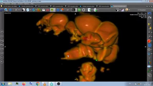 ОБЗОР ПО МОИМ МЫТАРСТВАМ С ОБСЛЕДОВАНИЯМИ. смотреть онлайн