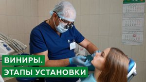 Виниры. Этапы установки виниров