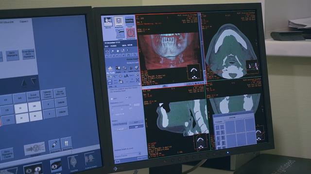 МРТ и МСКТ в Омске. смотреть онлайн