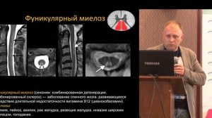 Лучевая диагностика миелопатий - Коновалов Родион Николаевич