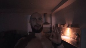 Избавься От Прыщей Раз и Навсегда. Простой и Бесплатный способ.