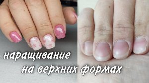 наращивание на верхних формах