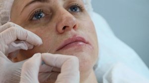 Мастер- класс филлер Juveline. Контурная пластика