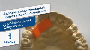 Д-р Чайка Зилия Салуатовна | ARKONA | Адгезивно-мостовидный протез в одно посещение