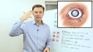 Как по глазам определить проблему по здоровью