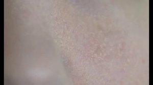 Покраснение и шелушение кожи на лице