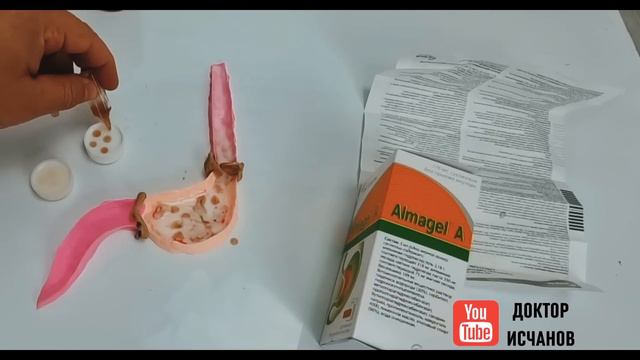 АЛМАГЕЛЬ ҚЎЛЛАШ ҚОИДАСИ ФОЙДАСИ ВА ЗАРАРЛАРИ смотреть онлайн