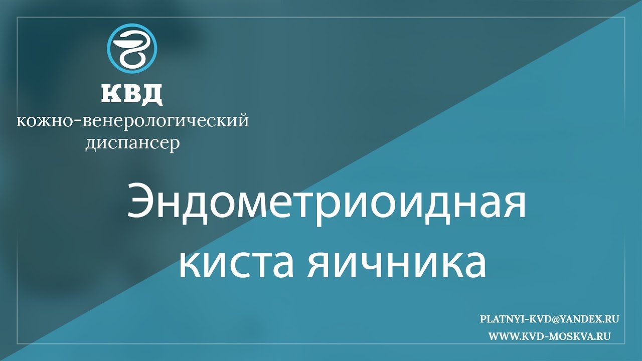 1049  Эндометриоидная киста яичника
