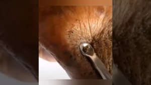 Самое залипательное новые  видео давить прыщи Черные точки