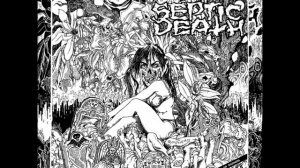 Septic Death   Now That I Have The Attention    1986 FULL ALBUM