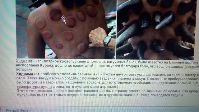 история хиджамы смотреть онлайн