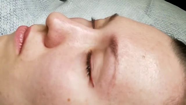 Удаление ремувером в области глаз смотреть онлайн