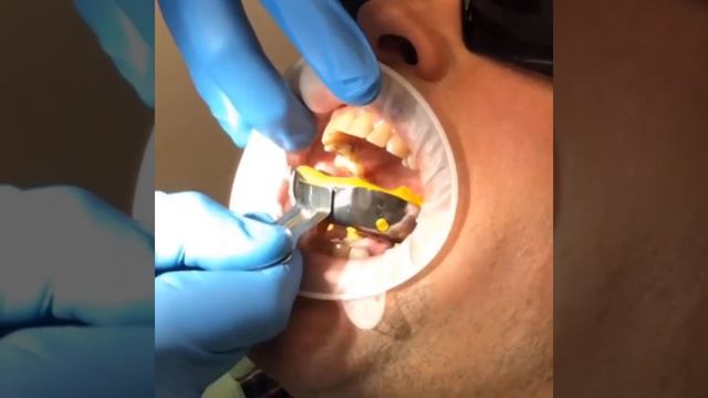 "Гибридный" оттиск. Александр Бисеров (Vra4evatel) смотреть онлайн