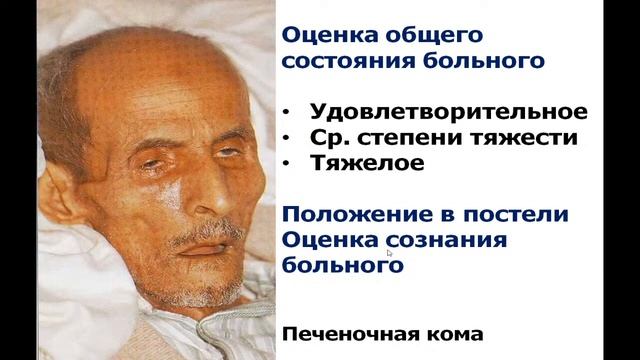 15:40 Основные симптомы и синдромы при заболеваниях печени.