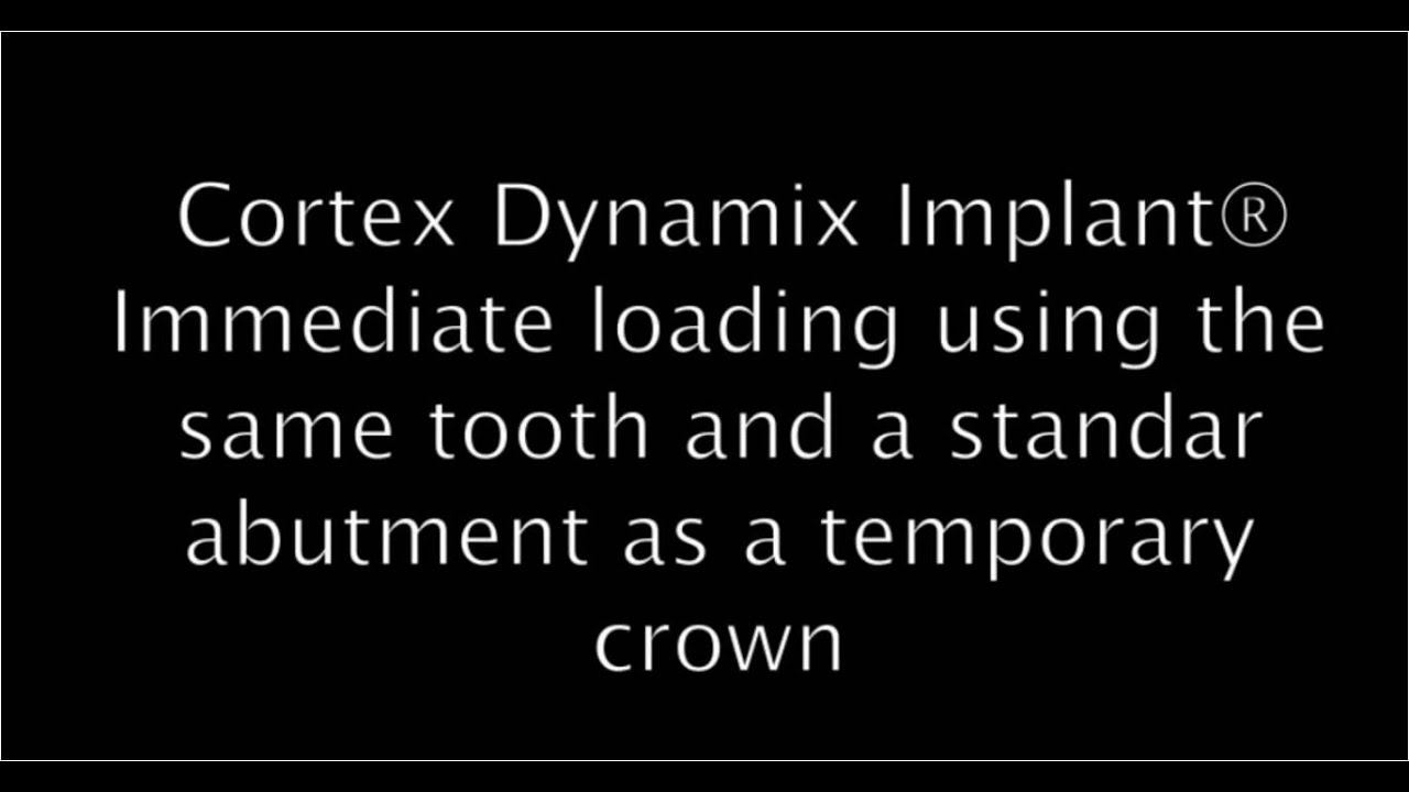 Имплантация с немедленной нагрузкой #Dynamix #имплантаты CORTEX