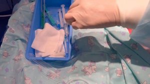 Катетеризация яремной вены