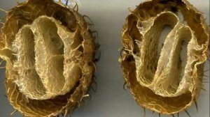 Как использовать бурнаки от гайморита! Лучшее средство от синусита