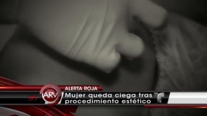 Alertan contra inyecciones para rejuvenecer el rostro | Al Rojo Vivo | Telemundo