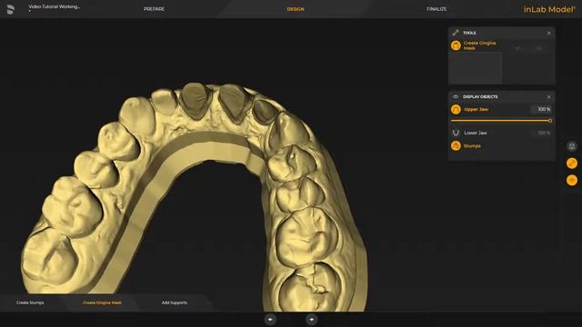 Primeprint Solution Workflow in order to manufacture a working model chairside (en) смотреть онлайн