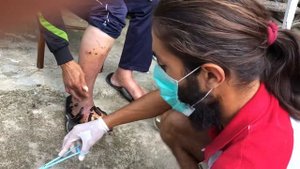 Лечение на Гангрена с Пиявици. Как Вылечить Гангрену с Помощью Гирудотерапии и Лечения Пиявками