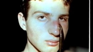 Лечение пиявками. Гирудотерапия © Treatment with leeches. Hirudotherapy