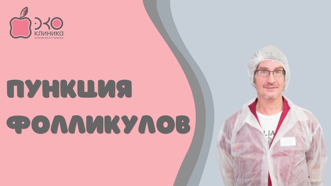 Пункция фолликулов