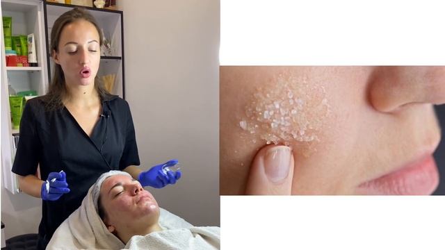 Каким пилингом закрыть чистку лица? /What peeling to close facial cleansing?