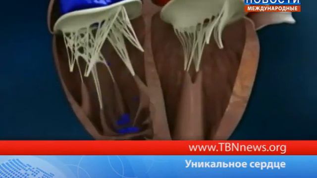 Уникальное сердце смотреть онлайн