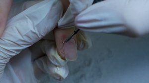 ИСКРОМСАЛИ КУСАЧКАМИ ? Сложный маникюр. ПОВРЕЖДЕННАЯ кожа. Наращивание ногтей БАЛЕРИНА?