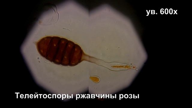 Ржавчина роз, R.canina L.