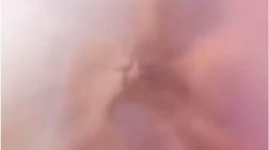 Эритроциты