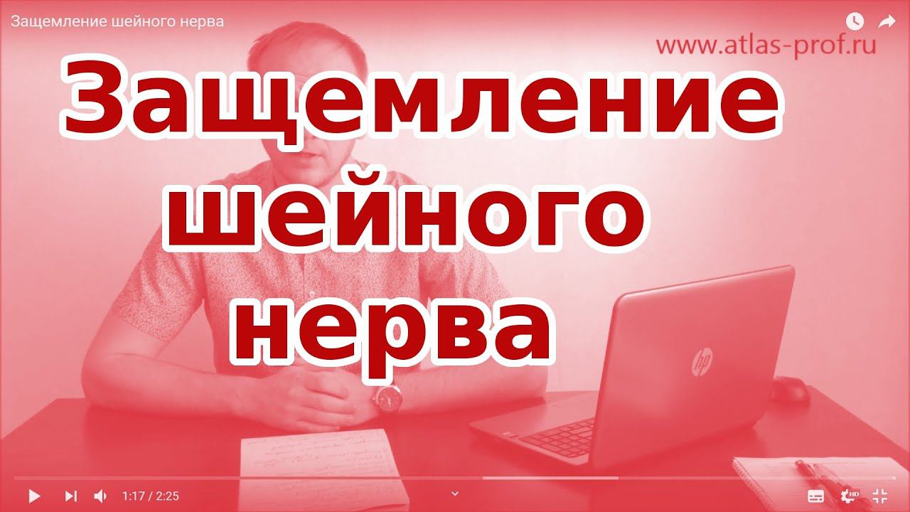ЗАЩЕМЛЕНИЕ шейного нерва | Зещемление что делать?