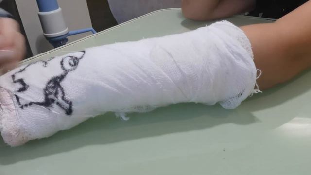 Рисуем на гипсе смотреть онлайн